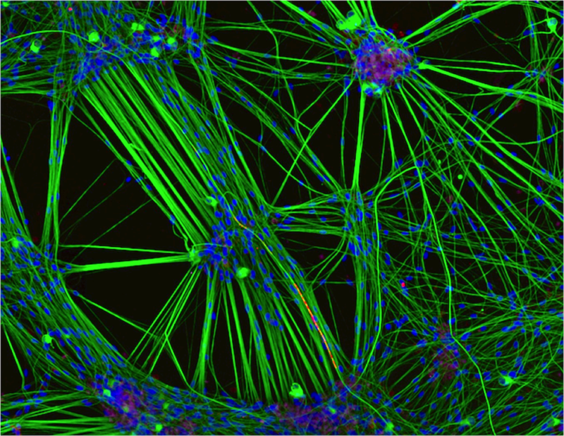Культура нейронов (окрашенный зеленый), полученные из клеток кожи человека, и шванновских клеток, второй тип клеток головного мозга (окрашенный красным) | Фото: Ребекка Nutbrown